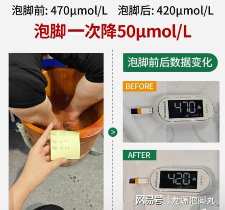 易倍体育网站：2024深圳智慧养老博览会现场体验科学泡脚降尿酸一次见效！(图3)