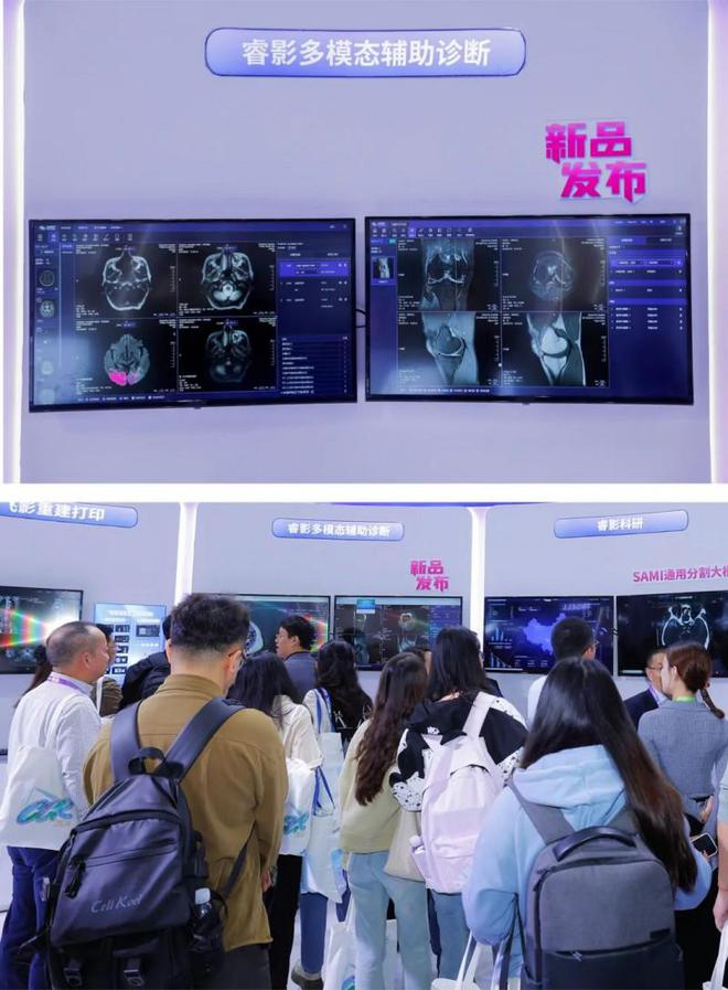 易倍体育网站：CCR2024深睿医疗多模态AI引领智能医疗新征程(图4)