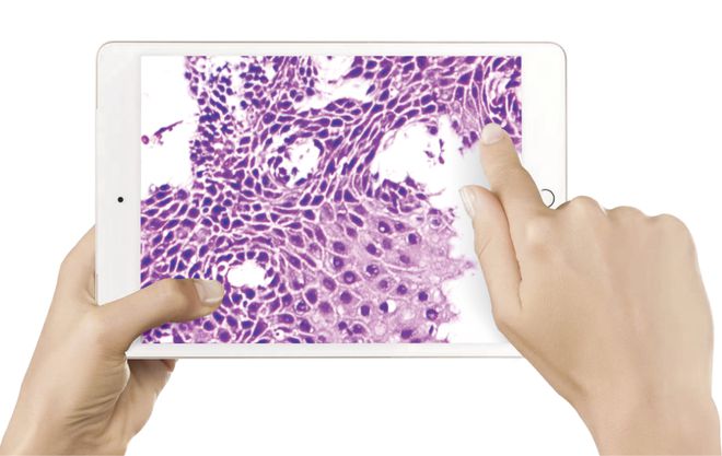 政策密集发布！百亿AI病理诊断市场的“预爆款”开售(图6)